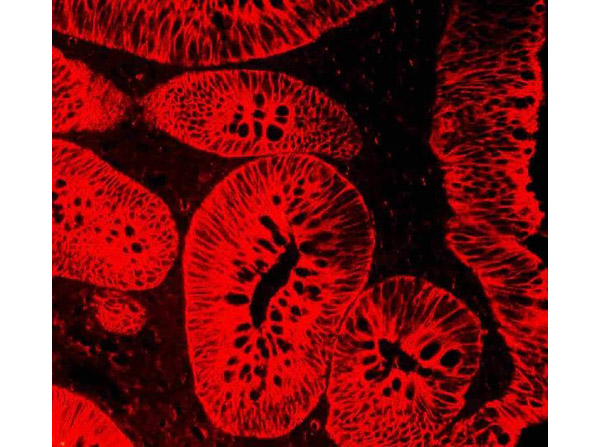 Immunofluorescence analysis of Cytokeratin Peptide 18